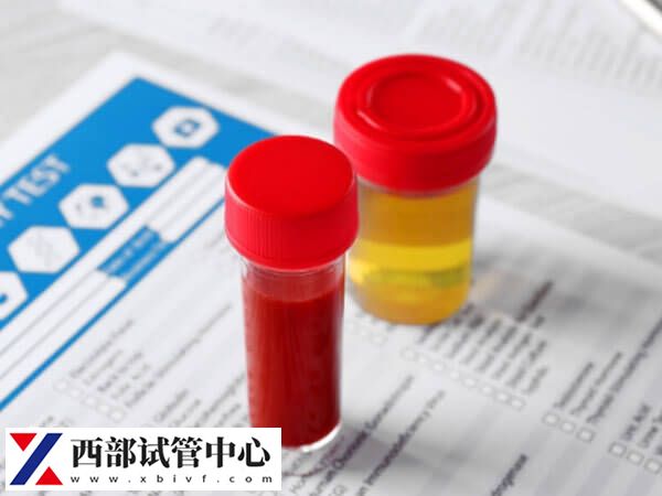 肥胖怎么做試管成功率高