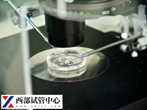 做三代試管需要基因篩查